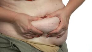Como aplicar cetosis nutricional