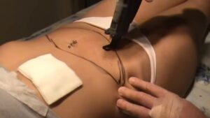 mesoterapia virtual