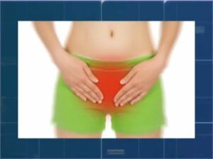 Enfermedades Urológicas Femeninas sintomas